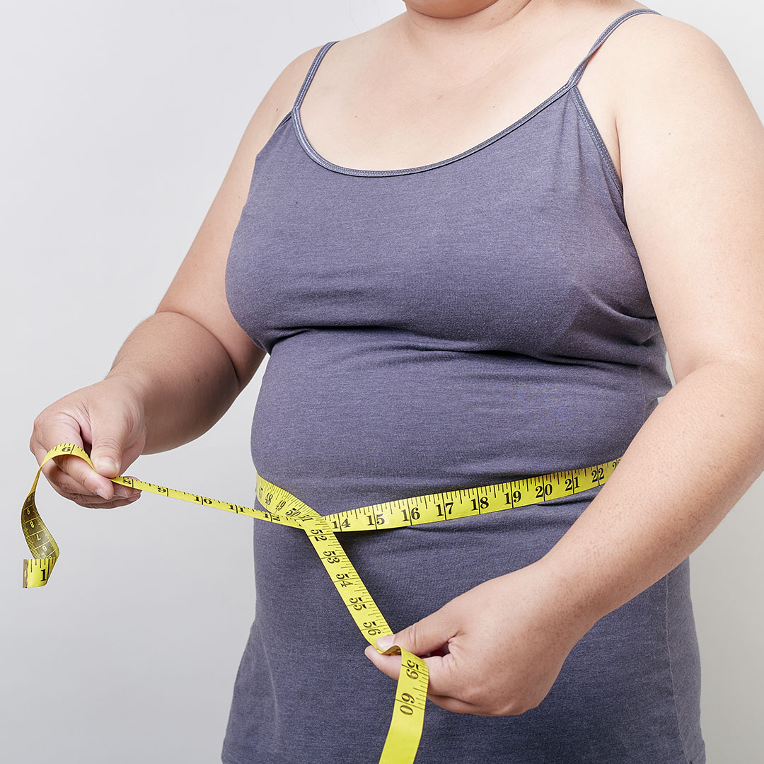 Nova proposta da Abeso e SBEM para classificar a obesidade e a perca de peso